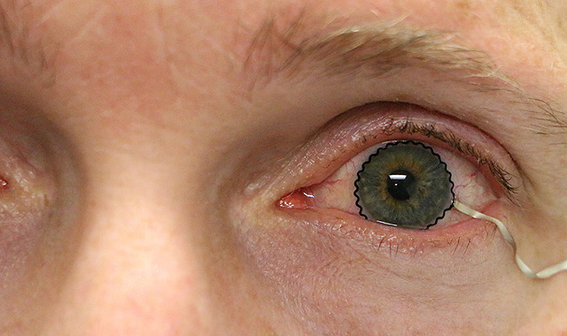 ソフトコンタクトレンズに角膜センサーを組み込む手法を開発――眼疾患の早期発見に役立つ可能性も - fabcross for エンジニア
