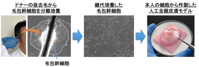 ドナーの抜去毛から毛包幹細胞を分離培養